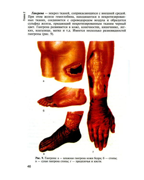 Патологическая анатомия и патологическая физиология: Учебник