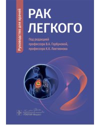 Рак легкого: руководство для врачей