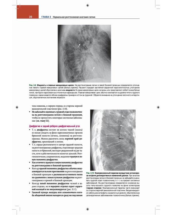 Лучевая диагностика. Основные принципы