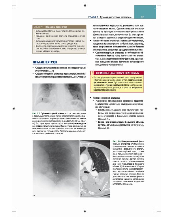 Лучевая диагностика. Основные принципы