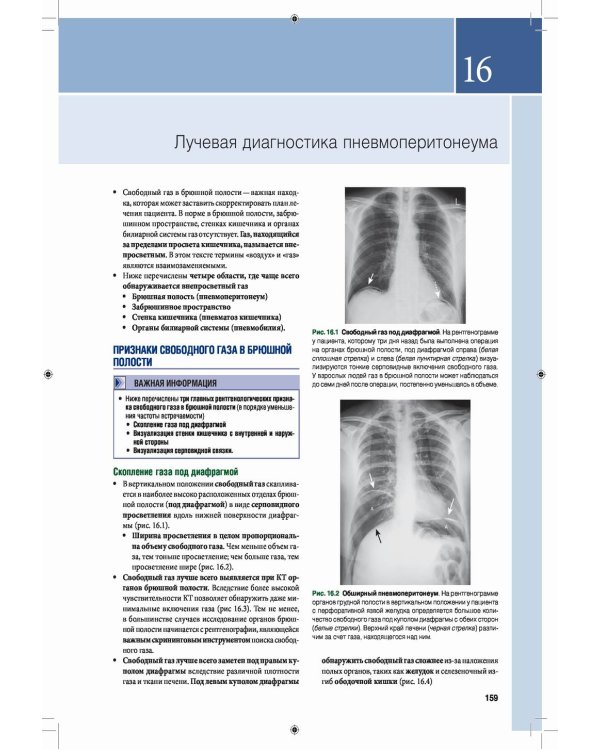 Лучевая диагностика. Основные принципы