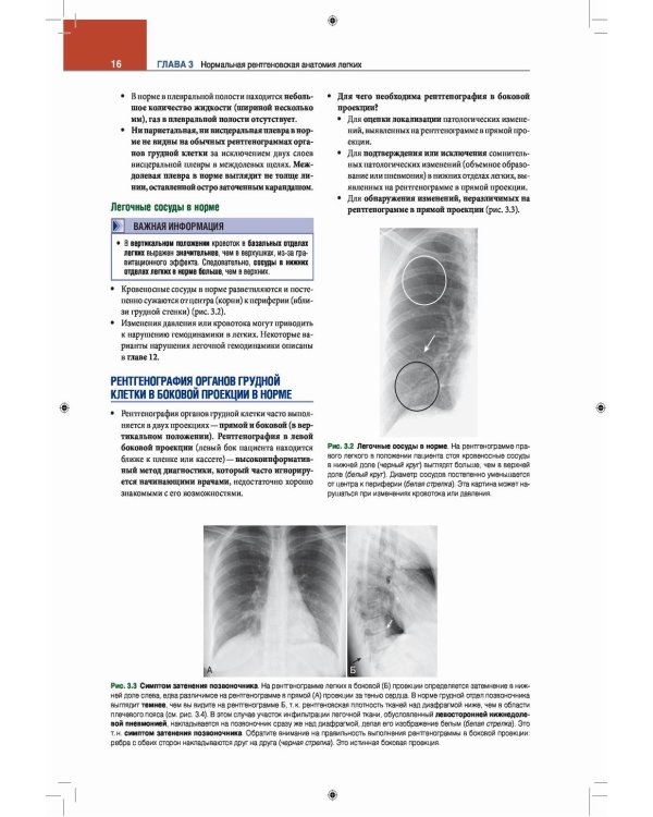 Лучевая диагностика. Основные принципы