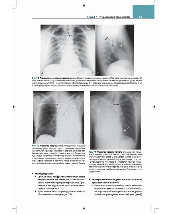Лучевая диагностика. Основные принципы