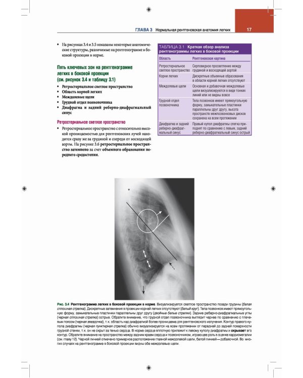 Лучевая диагностика. Основные принципы