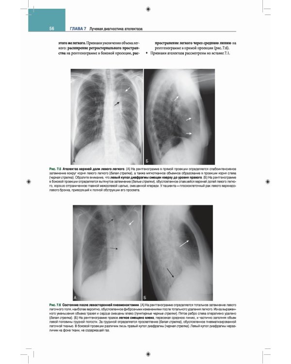 Лучевая диагностика. Основные принципы