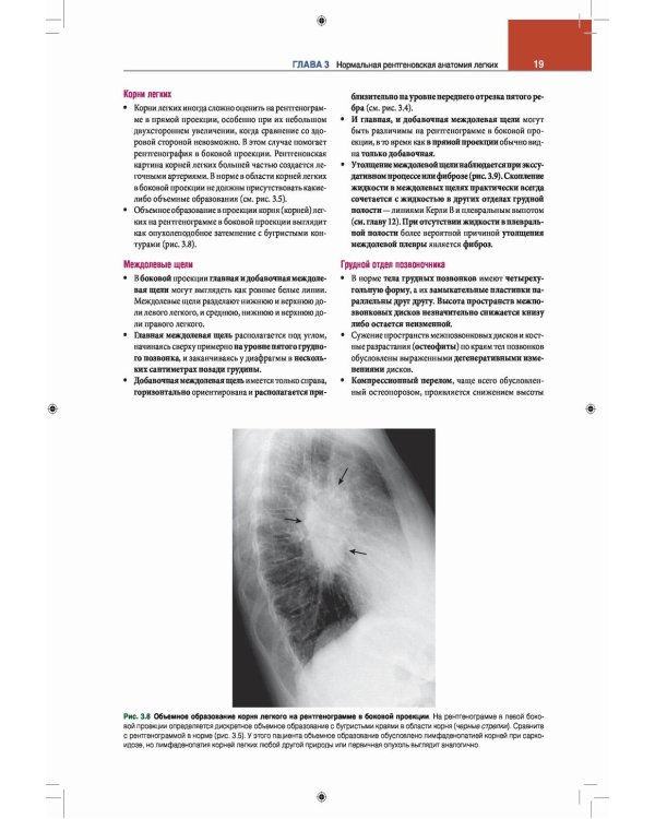 Лучевая диагностика. Основные принципы