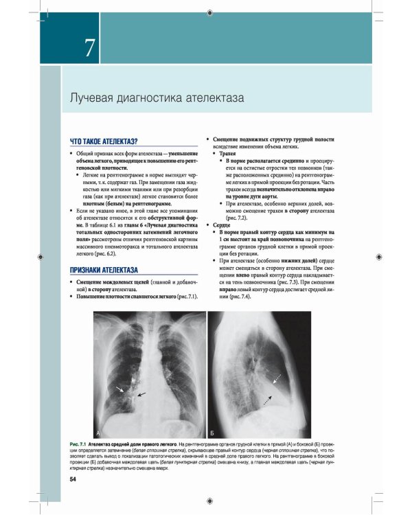 Лучевая диагностика. Основные принципы