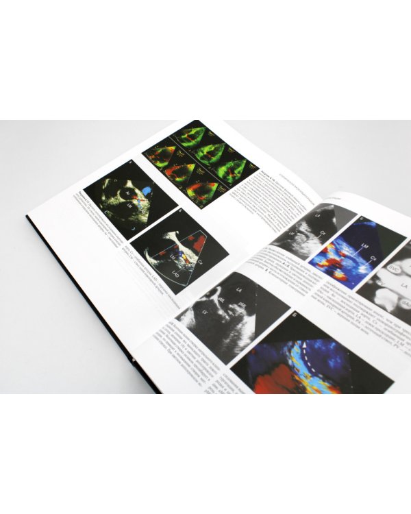 Клиническая эхокардиография. 4-е изд