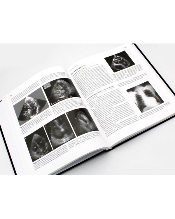 Клиническая эхокардиография. 4-е изд