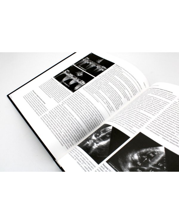 Клиническая эхокардиография. 4-е изд