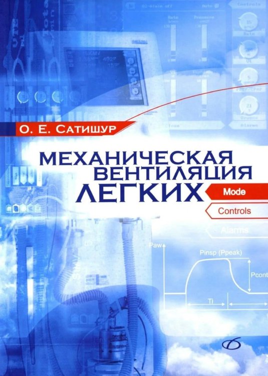 Механическая вентиляция легких