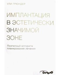 Имплантация в эстетически значимой зоне. Поэтапный алгоритм планирования лечения