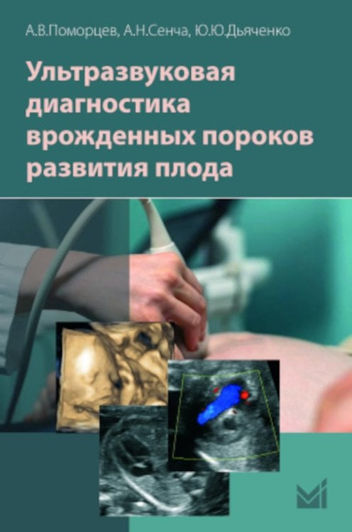 Ультразвуковая диагностика врожденных пороков развития плода Ультразвуковая диагностика врожденных пороков развития плода