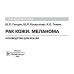 Рак кожи. Меланома: руководство для врачей
