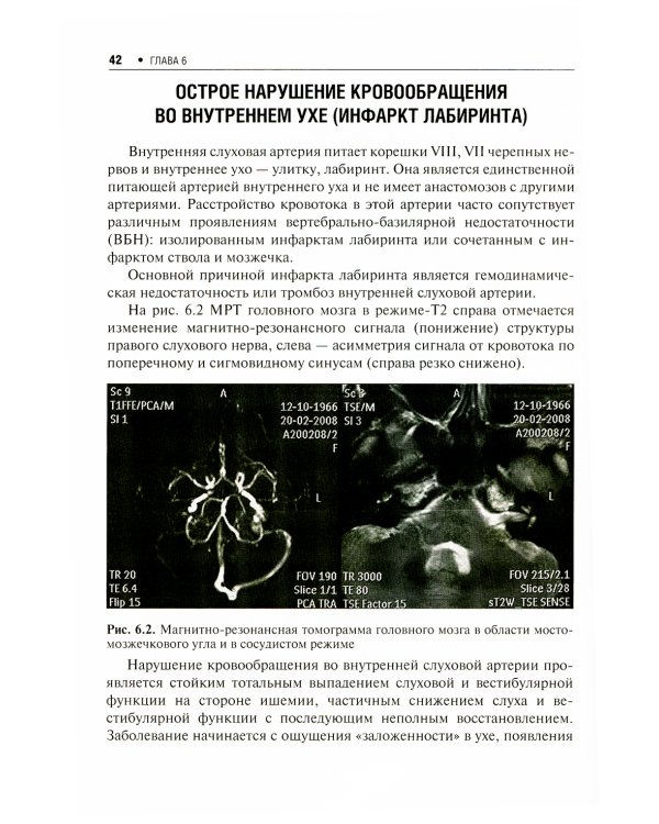 Практическая неврология
