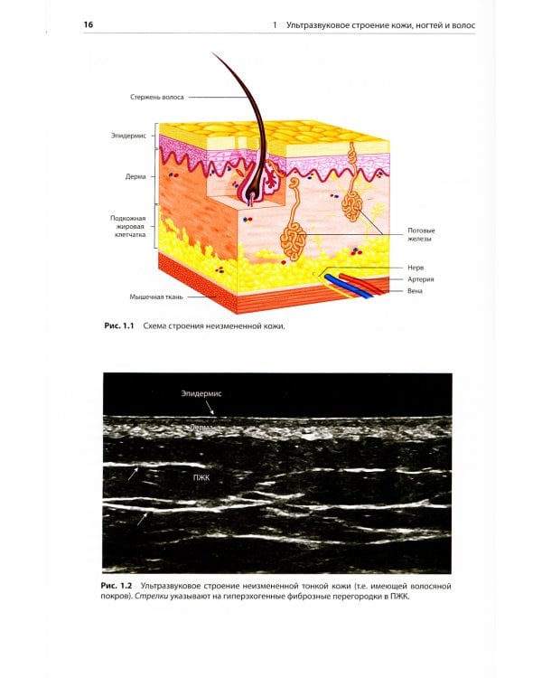 Атлас по ультразвуковому исследованию в дерматологии: мягкие ткани, кожа, придатки кожи