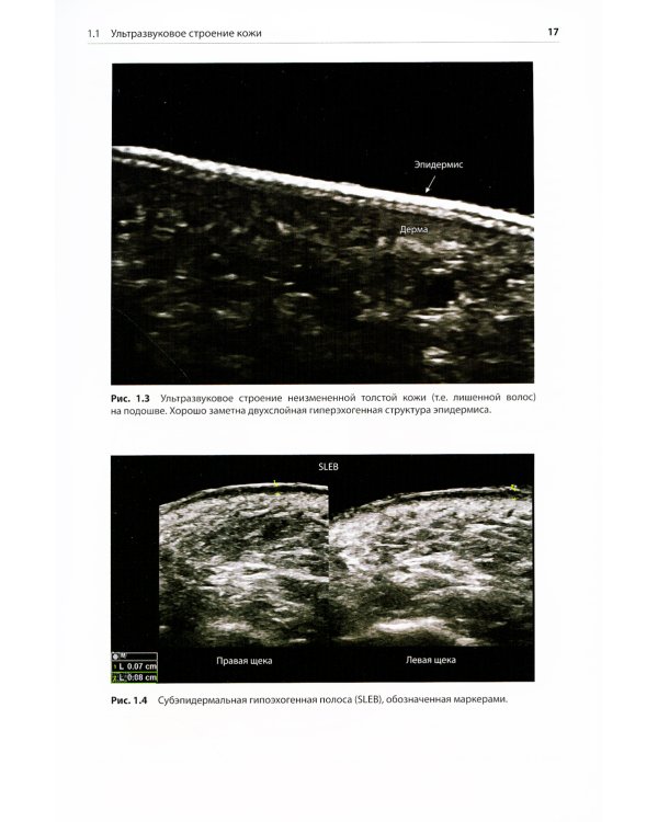 Атлас по ультразвуковому исследованию в дерматологии: мягкие ткани, кожа, придатки кожи
