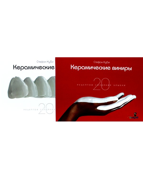 Керамические виниры