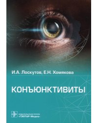 Конъюнктивиты