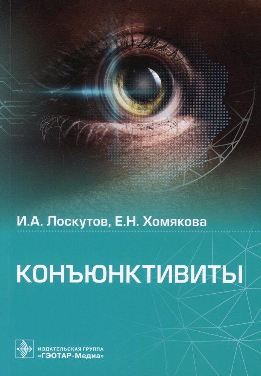 Конъюнктивиты Конъюнктивиты