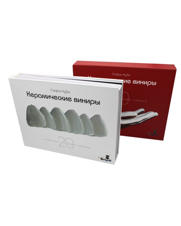 Керамические виниры