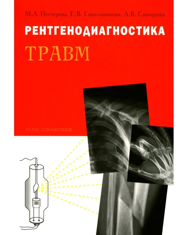 Рентгенодиагностика травм. Атлас-справочник