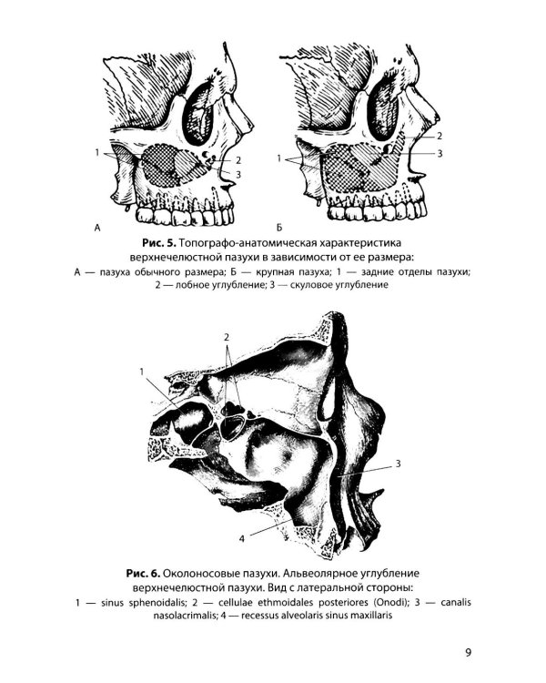 Функциональная анатомия околоносовых пазух: Учебное пособие