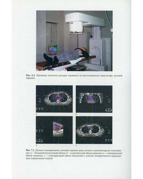 Лучевая терапия (радиотерапия): Учебник. 3-е изд., перераб. и доп