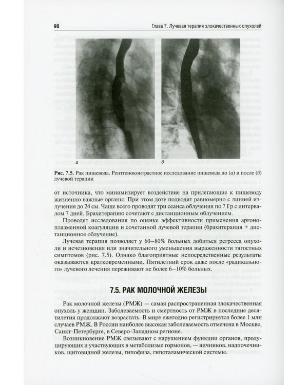 Лучевая терапия (радиотерапия): Учебник. 3-е изд., перераб. и доп