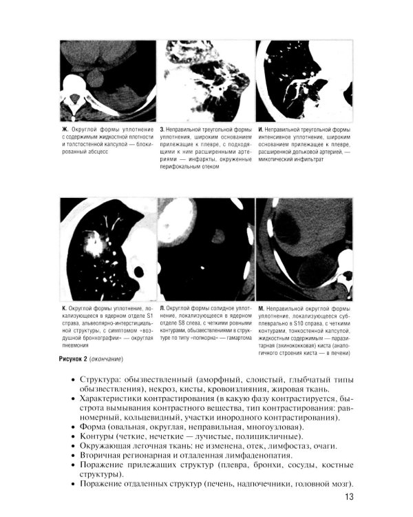Заключение в торакальной компьютерной томографии. Симптом, синдром, диагноз. 3-е изд
