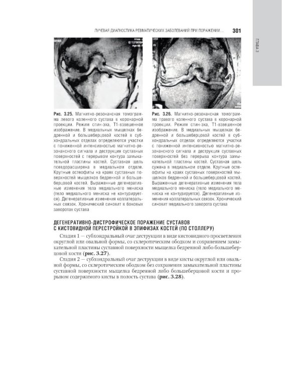 Лучевая диагностика заболеваний костей и суставов: национальное руководство. 2-е изд., перераб. и доп