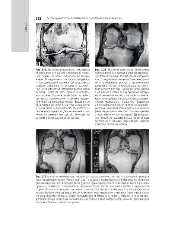 Лучевая диагностика заболеваний костей и суставов: национальное руководство. 2-е изд., перераб. и доп