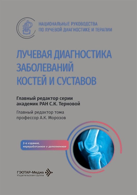 Лучевая диагностика заболеваний костей и суставов: национальное руководство. 2-е изд., перераб. и доп
