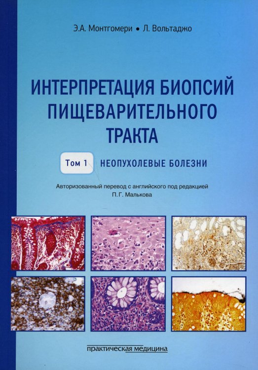 Интерпретация биопсий пищеварительного тракта. Т. 1: Неопухолевые болезни