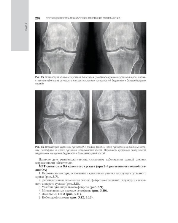 Лучевая диагностика заболеваний костей и суставов: национальное руководство. 2-е изд., перераб. и доп