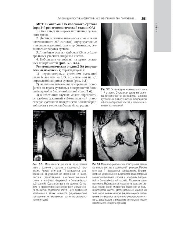 Лучевая диагностика заболеваний костей и суставов: национальное руководство. 2-е изд., перераб. и доп