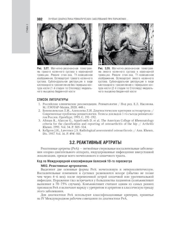 Лучевая диагностика заболеваний костей и суставов: национальное руководство. 2-е изд., перераб. и доп