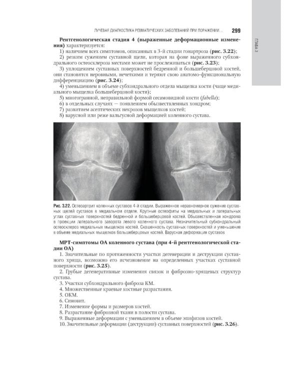 Лучевая диагностика заболеваний костей и суставов: национальное руководство. 2-е изд., перераб. и доп