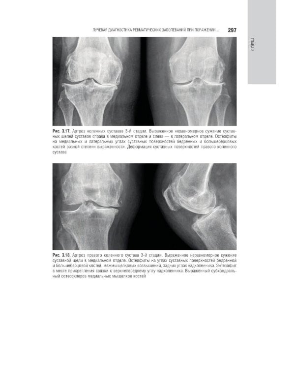Лучевая диагностика заболеваний костей и суставов: национальное руководство. 2-е изд., перераб. и доп