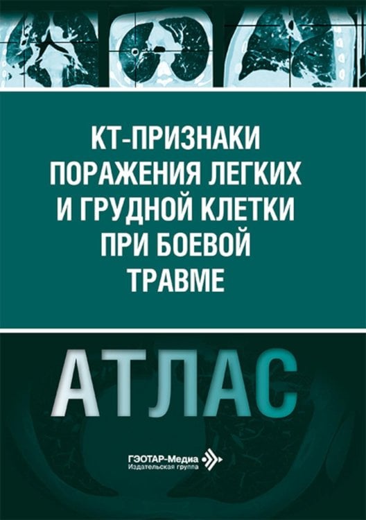 КТ-признаки поражения легких и грудной клетки при боевой травме: атлас