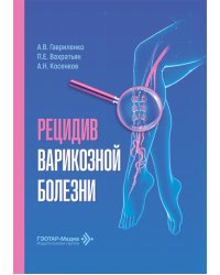 Рецидив варикозной болезни