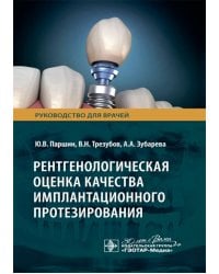 Рентгенологическая оценка качества имплантационного протезирования: руководство для врачей