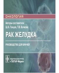 Рак желудка: руководство для врачей