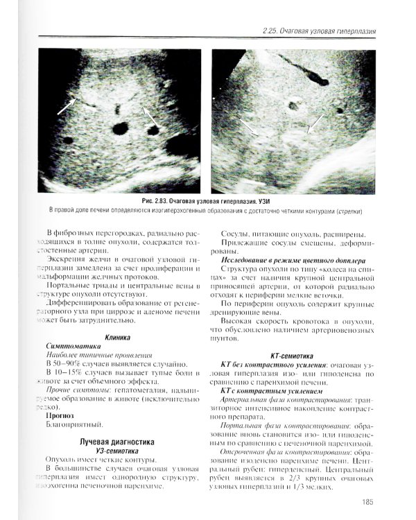 Визуализация заболеваний печени и желчевыводящих путей: Учебное пособие