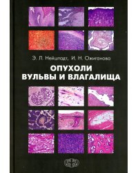 Опухоли вульвы и влагалища