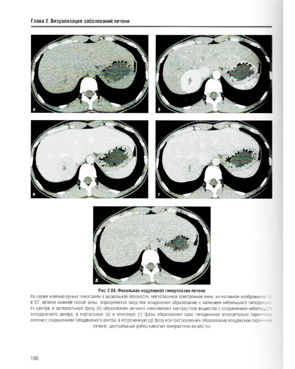 Визуализация заболеваний печени и желчевыводящих путей: Учебное пособие