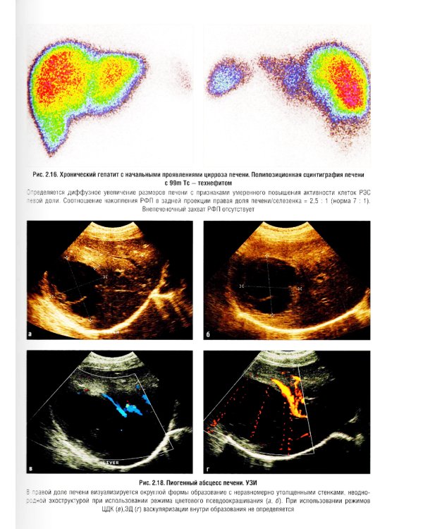 Визуализация заболеваний печени и желчевыводящих путей: Учебное пособие