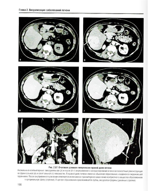 Визуализация заболеваний печени и желчевыводящих путей: Учебное пособие