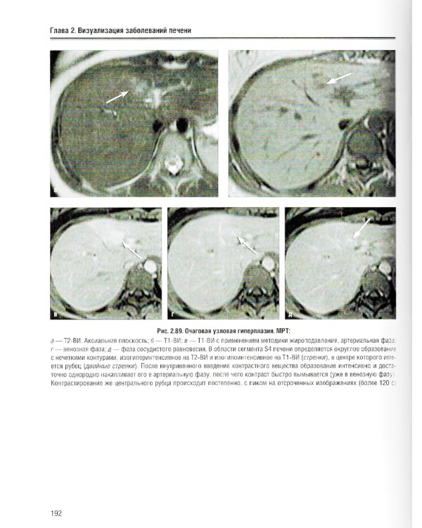 Визуализация заболеваний печени и желчевыводящих путей: Учебное пособие