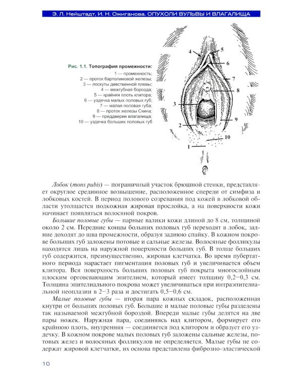 Опухоли вульвы и влагалища